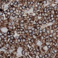 TNFSF11 / RANKL / TRANCE Antibody (Internal)