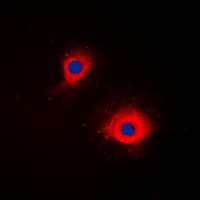 TNFSF11 / RANKL / TRANCE Antibody (Internal)