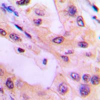 Polyclonal Rabbit anti-Human TNK2 / ACK1 Antibody (phospho-Tyr284, IHC, IF, WB)