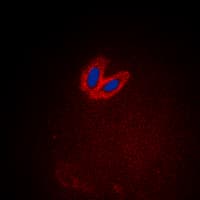 Polyclonal Rabbit anti-Human TNK2 / ACK1 Antibody (phospho-Tyr284, IHC, IF, WB)