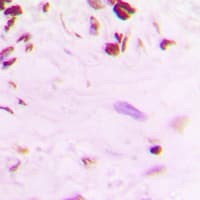 TP53 / p53 Antibody (C-Terminus)