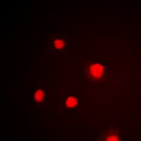 TP53 / p53 Antibody (C-Terminus)