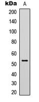 TP53 / p53 Antibody (Acetyl-Lys319)
