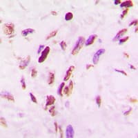 TP53 / p53 Antibody (Acetyl-Lys319)