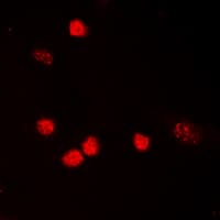 TP53 / p53 Antibody (Acetyl-Lys319)