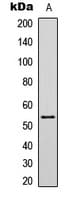 TP53 / p53 Antibody (Acetyl-Lys381)