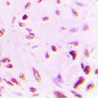 TP53 / p53 Antibody (Acetyl-Lys381)