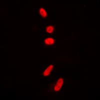 TP53 / p53 Antibody (Acetyl-Lys381)