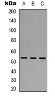 Polyclonal Rabbit anti-Human TRIM38 Antibody (Internal, WB)