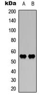 WASF3 Antibody (Internal)