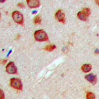 WASF3 Antibody (Internal)
