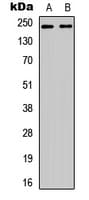 Polyclonal Rabbit anti-Human WNK1 Antibody (N-Terminus, IHC, WB)