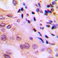 Polyclonal Rabbit anti-Human WNK1 Antibody (N-Terminus, IHC, WB)