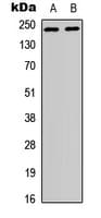 Polyclonal Rabbit anti-Human WNK1 Antibody (N-Terminus, IHC, WB)