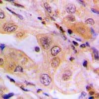 Polyclonal Rabbit anti-Human WNK1 Antibody (N-Terminus, IHC, WB)