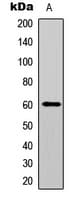Polyclonal Rabbit anti-Human AKT1 Antibody (C-Terminus, IHC, WB)