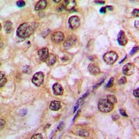 Polyclonal Rabbit anti-Human AKT1 Antibody (C-Terminus, IHC, WB)