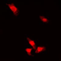 AKT1 Antibody (C-Terminus)