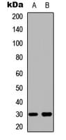 BCL2L1 / BCL-XL Antibody (Internal)