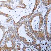 BCL2L1 / BCL-XL Antibody (Internal)