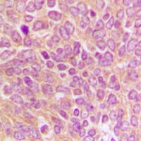CASP9 / Caspase 9 Antibody (C-Terminus)