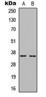 CCND1 / Cyclin D1 Antibody (C-Terminus)
