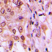 CCND1 / Cyclin D1 Antibody (C-Terminus)