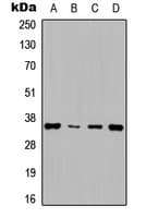 Polyclonal Rabbit anti-Human CCND1 / Cyclin D1 Antibody (Internal, WB)