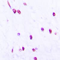 Polyclonal Rabbit anti-Human CDC25C Antibody (phospho-Ser216, IHC, IF, WB)