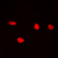 Polyclonal Rabbit anti-Human CDC25C Antibody (phospho-Ser216, IHC, IF, WB)