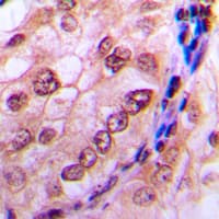 CDC6 Antibody (N-Terminus)