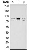 Polyclonal Rabbit anti-Human IKK Alpha+Beta Antibody (phospho-Ser176/177, WB)