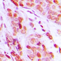 Polyclonal Rabbit anti-Human DAXX Antibody (C-Terminus, IHC, WB)