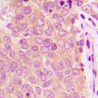 Polyclonal Rabbit anti-Human ESPL1 / Separase Antibody (Internal, IHC, IF, WB)