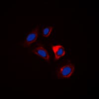 Polyclonal Rabbit anti-Human ESPL1 / Separase Antibody (Internal, IHC, IF, WB)