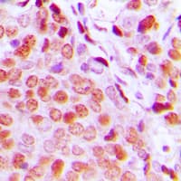 ER Alpha / Estrogen Receptor Antibody (Internal)