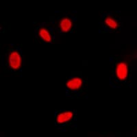 ER Alpha / Estrogen Receptor Antibody (Internal)