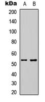 ETS1 / ETS-1 Antibody (N-Terminus)