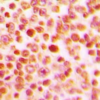ETS1 / ETS-1 Antibody (N-Terminus)