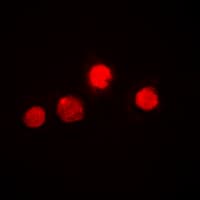 ETS1 / ETS-1 Antibody (N-Terminus)