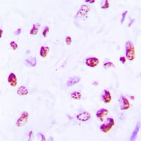 Polyclonal Rabbit anti-Human H2AFX / H2AX Antibody (C-Terminus, IHC, IF, WB)