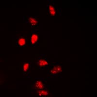 Polyclonal Rabbit anti-Human H2AFX / H2AX Antibody (C-Terminus, IHC, IF, WB)