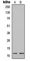 Polyclonal Rabbit anti-Human HIST1H3A Antibody (N-Terminus, IHC, WB)