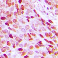 Polyclonal Rabbit anti-Human HIST1H3A Antibody (N-Terminus, IHC, WB)