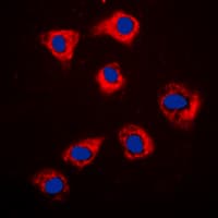 HSP90AB1 / HSP90 Alpha B1 Antibody (Internal)