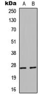 HSPB1 / HSP27 Antibody (Internal)