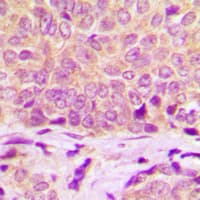 HSPB1 / HSP27 Antibody (Internal)
