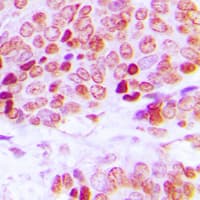 Polyclonal Rabbit anti-Human LMNA / Lamin A+C Antibody (N-Terminus, IHC, WB)