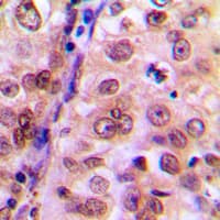 Polyclonal Rabbit anti-Human MAPK14 / p38 Antibody (C-Terminus, IHC, WB)