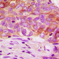 Polyclonal Rabbit anti-Human MTOR Antibody (C-Terminus, IHC, WB)